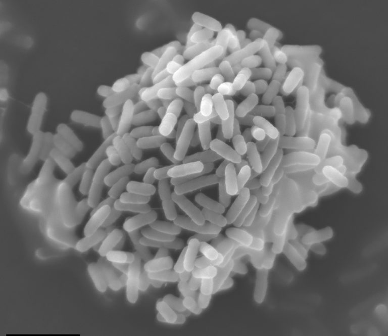 Study identifies genes that allow Salmonella to survive in dry